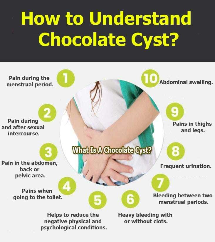 Chocolate Cyst graphic