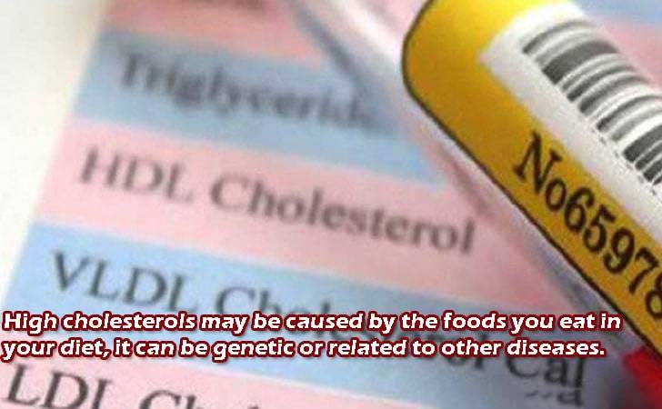 High cholesterols may be caused by the foods you eat